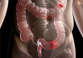 Dr. Patta Radhakrishna-Gastroenterology specialist