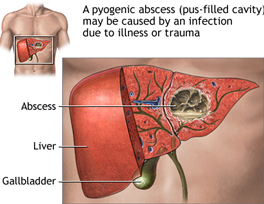 Dr. Patta Radhakrishna-Gastroenterology specialist