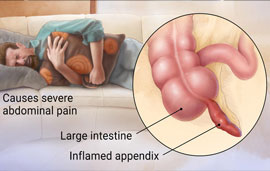 Dr. Patta Radhakrishna-Gastroenterology specialist
