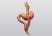 Dr. Patta Radhakrishna-Gastroenterology specialist