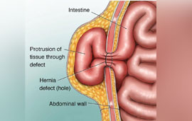 Dr. Patta Radhakrishna-Gastroenterology specialist