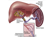 Dr. Patta Radhakrishna-Gastroenterology specialist