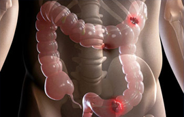 Dr. Patta Radhakrishna-Gastroenterology specialist