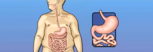 Dr. Patta Radhakrishna-Gastroenterology specialist