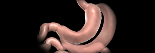 Dr. Patta Radhakrishna-Gastroenterology specialist