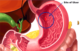 Dr. Patta Radhakrishna-Gastroenterology specialist